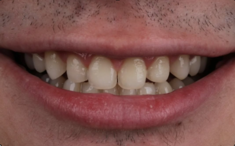 Sorriso antes do tratamento